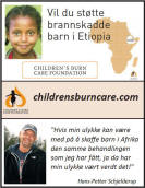 Sttt brannskadde barn i Etiopia